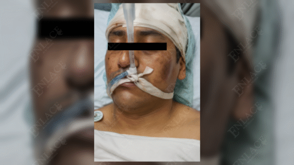 Identifican a víctima de ataque con machete; era de Tilapa