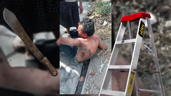 Agreden con machete a hombre por no devolver escalera en Izúcar